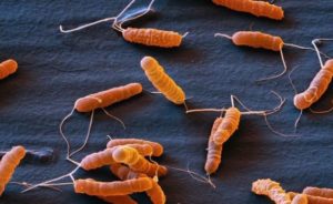 Choroba wrzodowa – przyczyny, objawy i leczenie